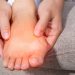 Serious signs on feet indicate diabetes 19 Serious signs on feet indicate diabetes