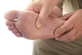 Serious signs on feet indicate diabetes