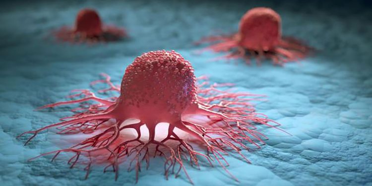 New method reduces cancer by 60%