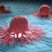 New method reduces cancer by 60% 18 New method reduces cancer by 60%