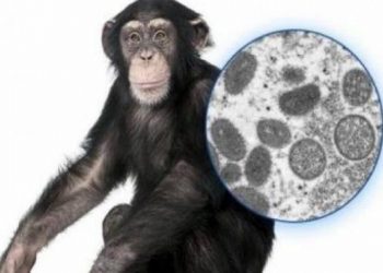 جدري القرود