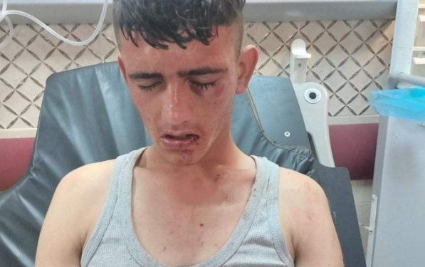 Foreign warns against escalating Palestinian boys' kidnappings by settlers