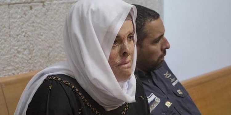 Israel rejects severely burned detainee's need to undergo surgeries