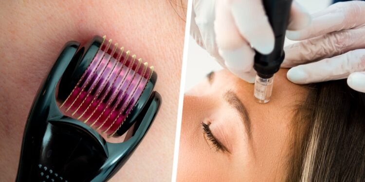 ​​What is Microneedling?
