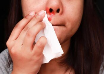 Tanzania announces mysterious disease killed people