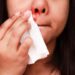 Tanzania announces mysterious disease killed people 21 Tanzania announces mysterious disease killed people
