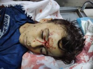 Israel commits massacre against civilians in Gaza, 5 kids killed