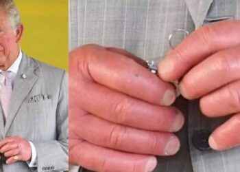 ما سر تورم أصابع الملك تشارلز الثالث؟