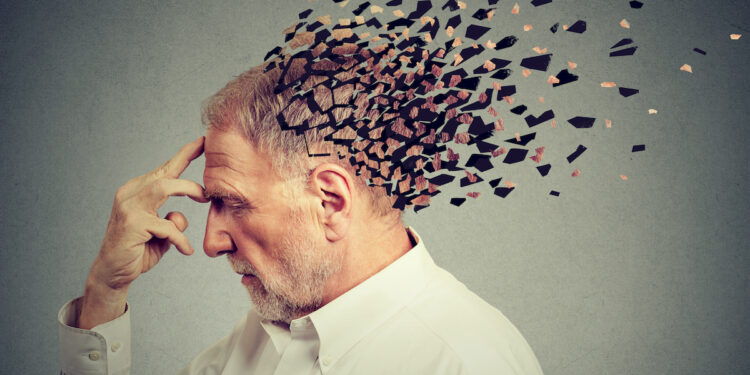 The #1 Root Cause of Alzheimer's, Say Physicians