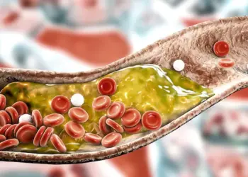 7 علاجات من الطبيعة لارتفاع الكوليسترول