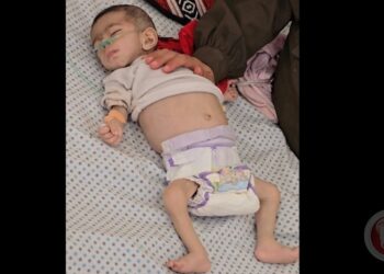 استشهاد طفلة في غزة بسبب المجاعة ما يرفع الحصيلة إلى 54