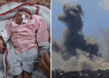 ولادة طفلة “بلا دماغ” مع تزايد ظاهرة “تشوه الأجنة” في قطاع غزة