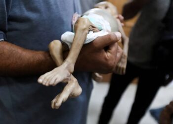 11 حالة وفاة جديدة نتيجة المجاعة بغزة خلال 24 ساعة